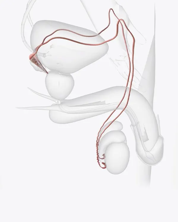 img-reversion-de-vasectomia-en-bogota-1